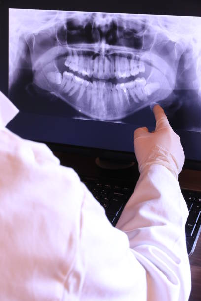 Best Emergency Dental Care for Broken or Chipped Teeth in Millersburg, PA