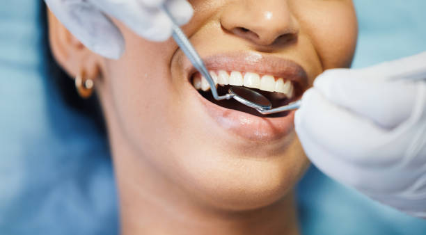 Best Emergency Treatment for Dental Infections or Abscesses in Millersburg, PA