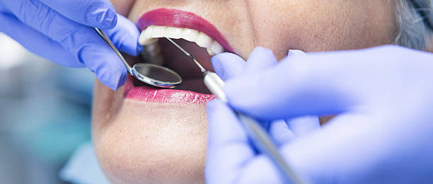 Best Emergency Dental Care for Broken or Chipped Teeth in Millersburg, PA